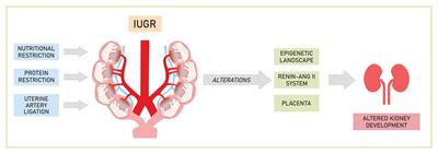 Frontiers Programmed Adult Kidney Disease Importance of Fetal